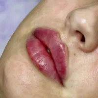 نیازمندمدل تزریق فیلر چانه،لب،زاویه، گونه کات|خدمات آرایشگری و زیبایی|تهران, صد دستگاه|دیوار