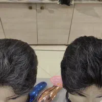 کلاه گیس مردانه زنانه الیافی و طبیعی