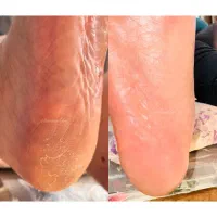 پدیکور خیس و کفسابی و خدمات دست|خدمات آرایشگری و زیبایی|رشت, انصاری|دیوار