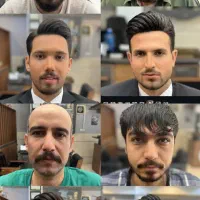 پروتز مو گریم تخصصی داماد