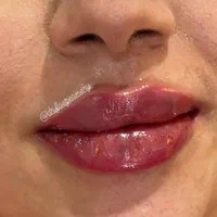 سونوصورت ژل لب بوتاکس فیلر لیفت نخ لیزر مو مادلینگ|خدمات آرایشگری و زیبایی|تهران, تهرانپارس شرقی|دیوار