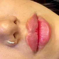 ژل لب ،زاویه سازی،فیلر چانه ،فول فیس|خدمات آرایشگری و زیبایی|مشهد, سجاد شهر|دیوار