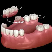 پروتز پارسیل و بریج در دانشکده با هزینه به صرفه|خدمات آرایشگری و زیبایی|تهران, پاسداران|دیوار