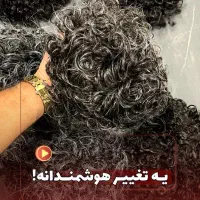 فروش پروتزمو