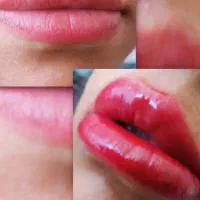 میکرو بلیدینگ و شیدینگ