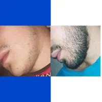 برا ریشات ارزش قائل باش