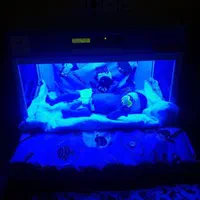 اجاره دستگاه درمان زردی نوزاد  / فتوتراپی پیشرفته