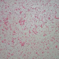 کنتکس رولکس کنیتکس