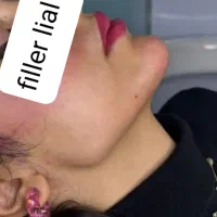 آف محدود ژل و بوتاکس فقط سی سی۴۵۰تا آخر هفته|خدمات آرایشگری و زیبایی|اهواز, پردیس|دیوار