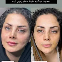 بوتاکس ژل آنزیم نخ لاغری بوتاکس 500وژل اودری350|خدمات آرایشگری و زیبایی|قم, هفت تیر|دیوار