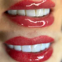 میکروبلیدینگ ، کراتین ، پرتئین ، مژه موقت
