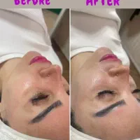 فیشیال تخصصی  پوست