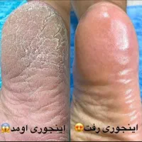 انجام خدمات کاشت ناخن وپدیکور