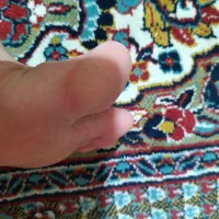 از بین بردن ترک پاشنه پا در یک جلسه  تضمینی|خدمات آرایشگری و زیبایی|شیراز, ماه فیروزان|دیوار
