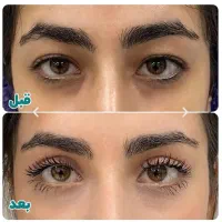 مرکز تخصصی پوست و مو بلفاروپلاستی|خدمات آرایشگری و زیبایی|تهران, جردن|دیوار