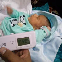 اجاره دستگاه کاهش زردی نوزاد +ازمایش زردی نوزاد