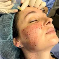 آموزش تخصصی تزریقات زیبایی و لیزر|خدمات آموزشی|اندیشه, اندیشه فاز ۱|دیوار