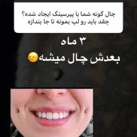 فروش و اجرای پیرسینگ|بدلیجات|فولادشهر, B4|دیوار