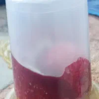حجامت و فصد خون