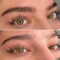 میکروبلیدینگ(فیبروز) ابرو