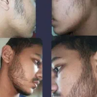 اگه هنوز ریشات درنیومده از این معجزه استفاده کن