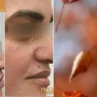 کرمهای ضدآفتاب بی رنگ و رنگی کرم ضدلک رضایت مشتری