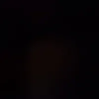 سلام اچار ماشین گمشده اطراف بازار