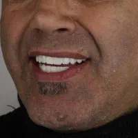 استخدام منشی تلفنی برای کالسنتر دندانپزشکی|استخدام بازاریابی و فروش|تهران, فلسطین (میدان انقلاب)|دیوار