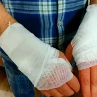 تزریقات،پانسمان،سرم،حجامت،فصدشبانه روزی درمنزل|خدمات آرایشگری و زیبایی|خرمآباد, |دیوار