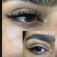 کاشت مژه هیدن