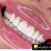 کامپوزیت دندان، روکش، دندانپزشکی تخصصی تهرانسر|خدمات آرایشگری و زیبایی|تهران, تهرانسر مرکزی|دیوار