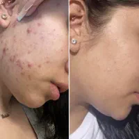 اگ تو هم مشکل جوش داری کلمه جوش رو دایرکت کن