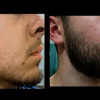 امضای مردانگی ریش پرپشت صورتت