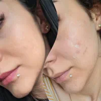 آموزش پاکسازی پوست فیشیال فیشال|خدمات آموزشی|کرمانشاه, |دیوار