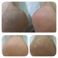 پدیکور وکفسابی