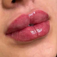 کلینیک زیبایی دکتر نازنین نعمتی/خدمات بوتاکس،ژل،نخ|خدمات آرایشگری و زیبایی|تهران, مرزداران|دیوار