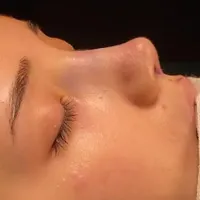 خدمات عمل جراحی زیبایی بینی و ترمیم بینی|خدمات آرایشگری و زیبایی|تهران, فلاح|دیوار