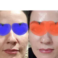 مشکلات پوست و مو