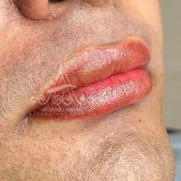 رفع تیرگی لب آقایان،میکروابرو،بُن مژه درمطب پزشک|خدمات آرایشگری و زیبایی|یزد, |دیوار