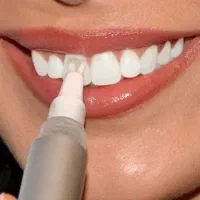 قلم سفید کننده دندان /لمینت/زیبایی/کامپوزیت|خدمات آرایشگری و زیبایی|اردبیل, |دیوار
