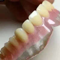 دندان مصنوعی طرح لبخند کامپوزیتی|آرایشی، بهداشتی، درمانی|ارومیه, |دیوار