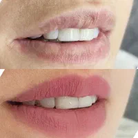 اصلاح فرم و‌ رنگ لب