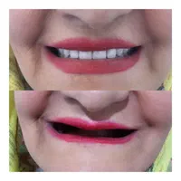 دندانسازی(بلوارهدایت)دندان مصنوعی/دندان سازی|خدمات آرایشگری و زیبایی|مشهد, هدایت|دیوار