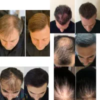 موهات کم پشت شده. این اگهی رو ببین