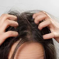 درمان صدرصدقطعی وتضمینی شپش ورشک برای همیشه