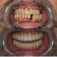 اقساط دندانپزشکی بدون پرداخت پول کلیه خدمات|خدمات آرایشگری و زیبایی|اصفهان, دشتستان|دیوار