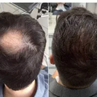 این دفعه دیگه قطعیه
