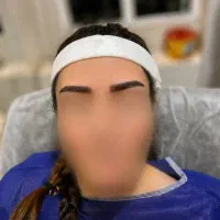 کاشت ابرو و مو طبیعی