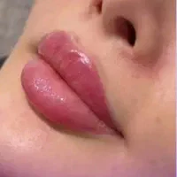 مطب زیبایی با دکتر مجرب جشنواره نوروزی