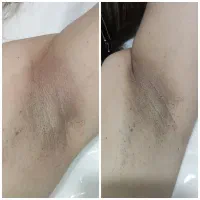 رفع تیرگی بدن/ روشن کننده بدن /زیربغل/بیکینی/صورت|خدمات آرایشگری و زیبایی|اهواز, سپیدار|دیوار